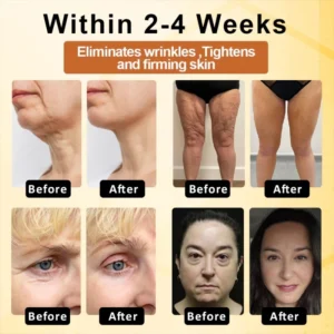 LOVILDS™ BotoxBee Advanced Multi Action Firming Cream 23 LOVILDS™ BotoxBee Advanced Multi Action Firming Cream