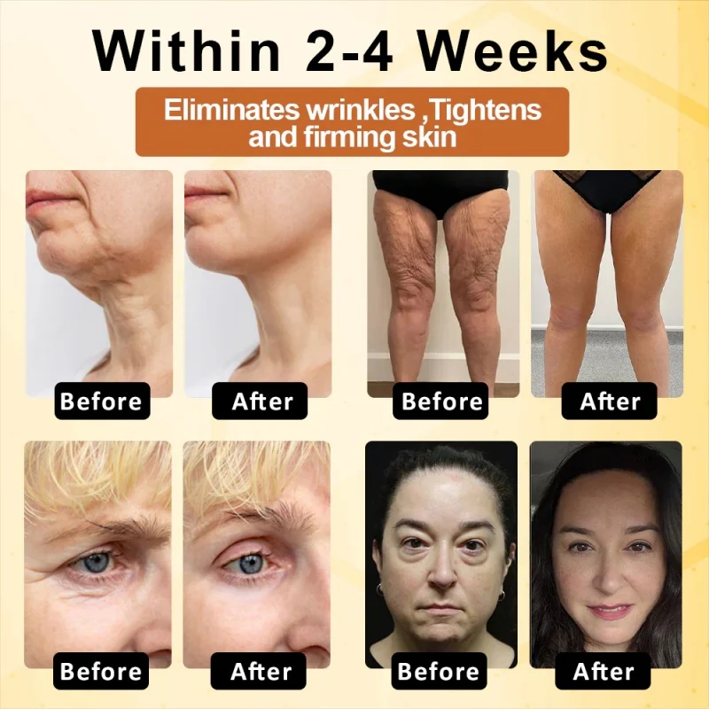 LOVILDS™ BotoxBee Advanced Multi Action Firming Cream 7 LOVILDS™ BotoxBee Advanced Multi Action Firming Cream