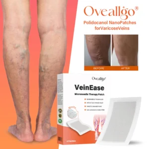 Oveallgo® VeinEase Microneedle Therapy Patch 10 Oveallgo® VeinEase Microneedle Therapy Patch