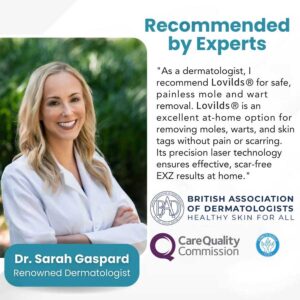 Lovilds® Non-Invasive Mole and Wart Removal Laser Pen 14 Lovilds® Non-Invasive Mole and Wart Removal Laser Pen