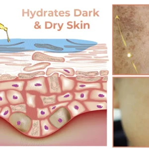 NESLEMY™ Melanin Correcting Facial Serum 20 NESLEMY™ Melanin Correcting Facial Serum