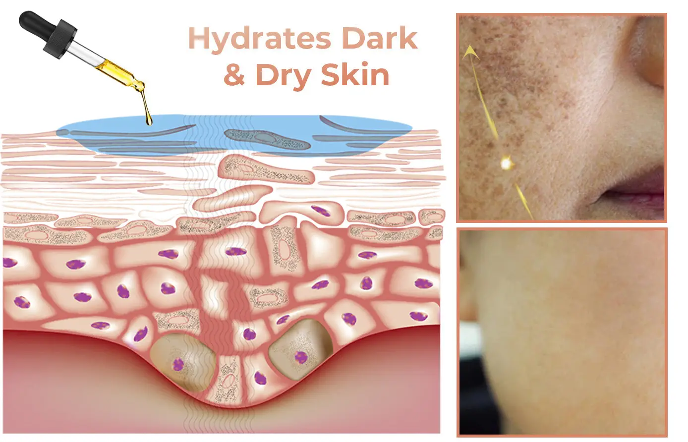 NESLEMY™ Melanin Correcting Facial Serum 10 NESLEMY™ Melanin Correcting Facial Serum