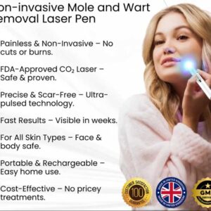 Lovilds® Non-Invasive Mole and Wart Removal Laser Pen 13 Lovilds® Non-Invasive Mole and Wart Removal Laser Pen