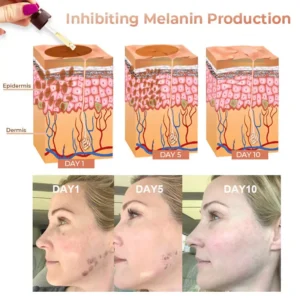 NESLEMY™ Melanin Correcting Facial Serum 19 NESLEMY™ Melanin Correcting Facial Serum