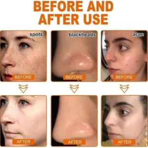 LOVILDS™ Whitening and Freckle – Removing Mask 22 LOVILDS™ Whitening and Freckle – Removing Mask