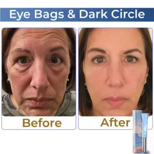 Lovilds™ Electric Anti Wrinkle Eye Cream 11 Lovilds™ Electric Anti Wrinkle Eye Cream