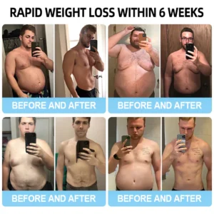 Lmipki® NIDDK-Tirzepatide Nano Microneedle Patch 27 Lmipki® NIDDK-Tirzepatide Nano Microneedle Patch