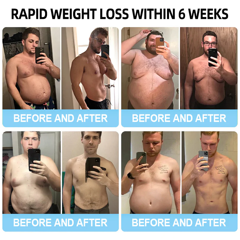 Lmipki® NIDDK-Tirzepatide Nano Microneedle Patch 14 Lmipki® NIDDK-Tirzepatide Nano Microneedle Patch