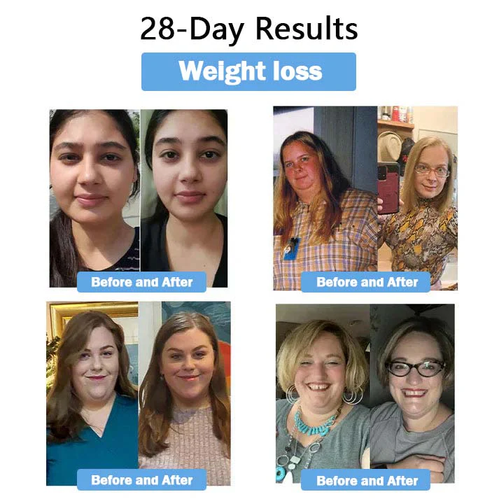 Lmipki® NIDDK-Tirzepatide Nano Microneedle Patch 5 Lmipki® NIDDK-Tirzepatide Nano Microneedle Patch