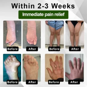 Fivfivgo™ Emu Oil JointRelief Ointment 17 Fivfivgo™ Emu Oil JointRelief Ointment