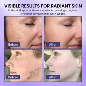 Luhaka® Radiglow Brightening Dark Spot Gel 6 Luhaka® Radiglow Brightening Dark Spot Gel