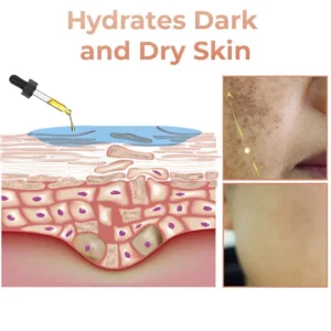 NESLEMY™ Melanin Correcting Facial Serum 21 NESLEMY™ Melanin Correcting Facial Serum