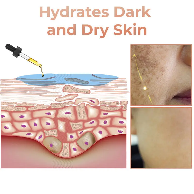 NESLEMY™ Melanin Correcting Facial Serum 11 NESLEMY™ Melanin Correcting Facial Serum