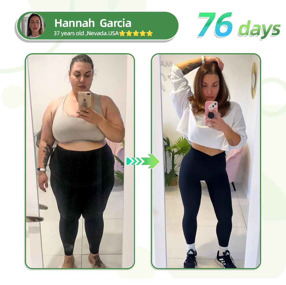 TLOPA® SMGT-GLP-1 Nano Microneedle Patch 10 TLOPA® SMGT-GLP-1 Nano Microneedle Patch