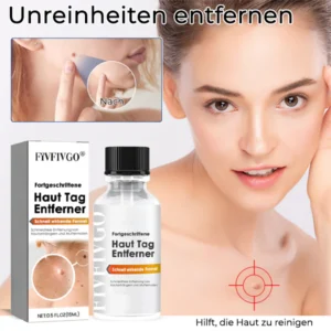 Fivfivgo® Bee Venom Tags & Moles Remover 9 Fivfivgo® Bee Venom Tags & Moles Remover