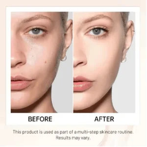LOVILDS™ Achieve Flawless Skin 24 LOVILDS™ Achieve Flawless Skin