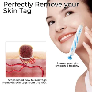 Fivfivgo™ At-home Skin Tag Removal Pen 6 Fivfivgo™ At-home Skin Tag Removal Pen