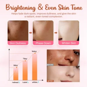 LOVILDS™ Whitening and Freckle – Removing Mask 14 LOVILDS™ Whitening and Freckle – Removing Mask