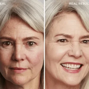 LOVILDS™ Achieve Flawless Skin 15 LOVILDS™ Achieve Flawless Skin