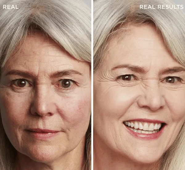 LOVILDS™ Achieve Flawless Skin 2 LOVILDS™ Achieve Flawless Skin