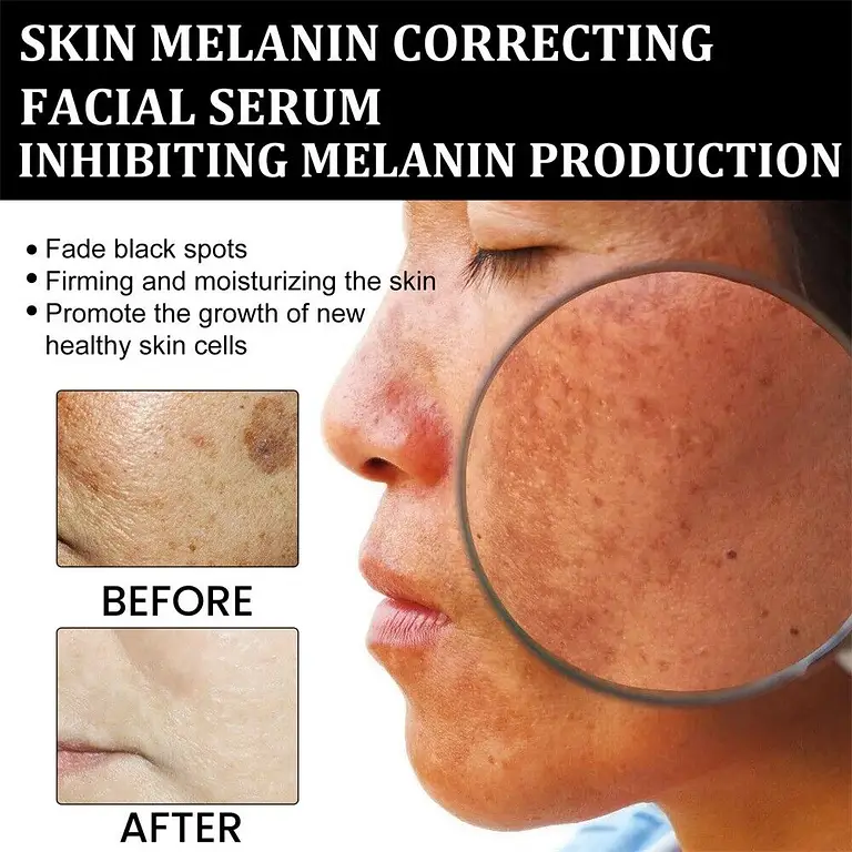 NESLEMY™ Melanin Correcting Facial Serum 2 NESLEMY™ Melanin Correcting Facial Serum