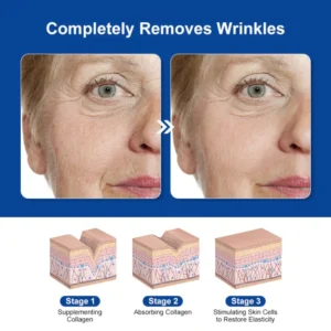 LOVILDS™ Bee Venom Skin Treatment Cream 15 LOVILDS™ Bee Venom Skin Treatment Cream