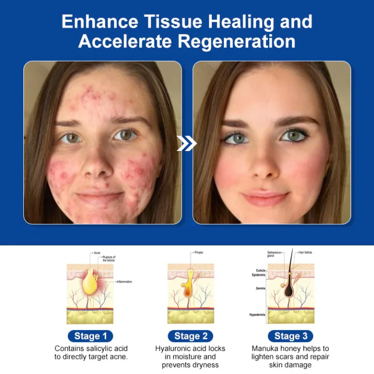 LOVILDS™ Bee Venom Skin Treatment Cream 5 LOVILDS™ Bee Venom Skin Treatment Cream