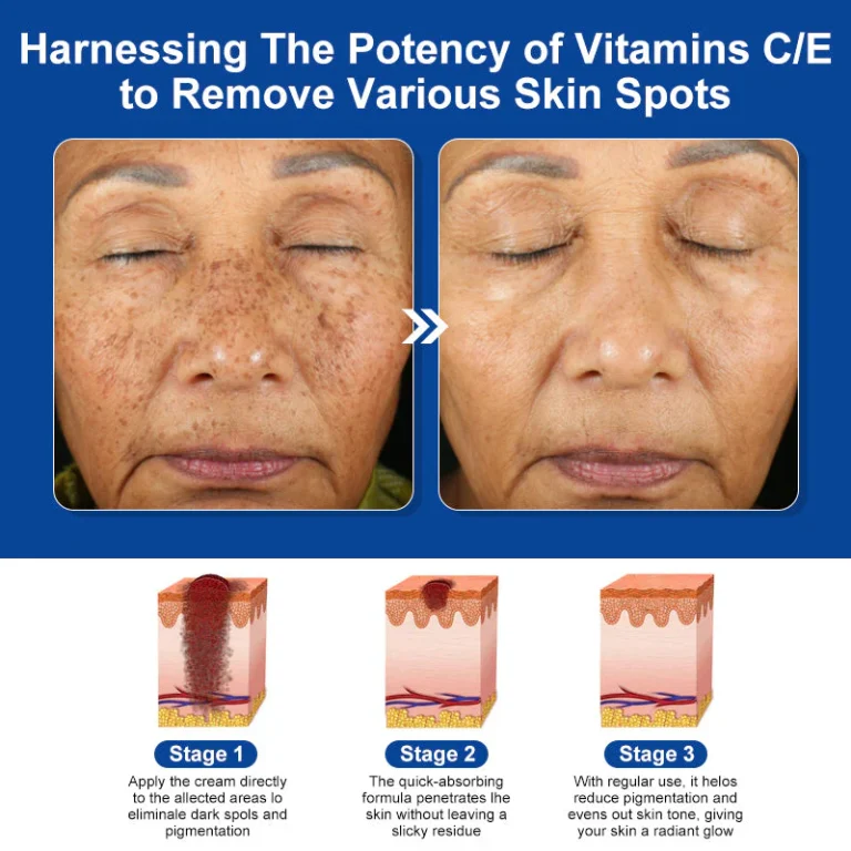 LOVILDS™ Bee Venom Skin Treatment Cream 4 LOVILDS™ Bee Venom Skin Treatment Cream