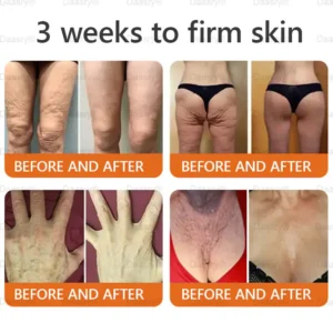 Daasry® “Dermal Gold” Botox Bee Venom Skin Restoration Cream 24 Daasry® “Dermal Gold” Botox Bee Venom Skin Restoration Cream