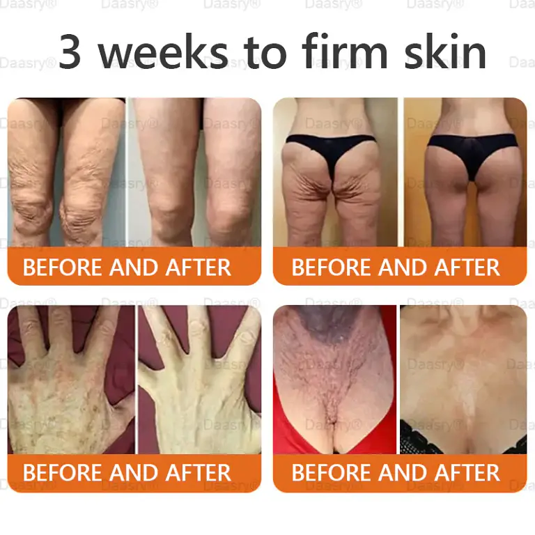 Daasry® “Dermal Gold” Botox Bee Venom Skin Restoration Cream 12 Daasry® “Dermal Gold” Botox Bee Venom Skin Restoration Cream