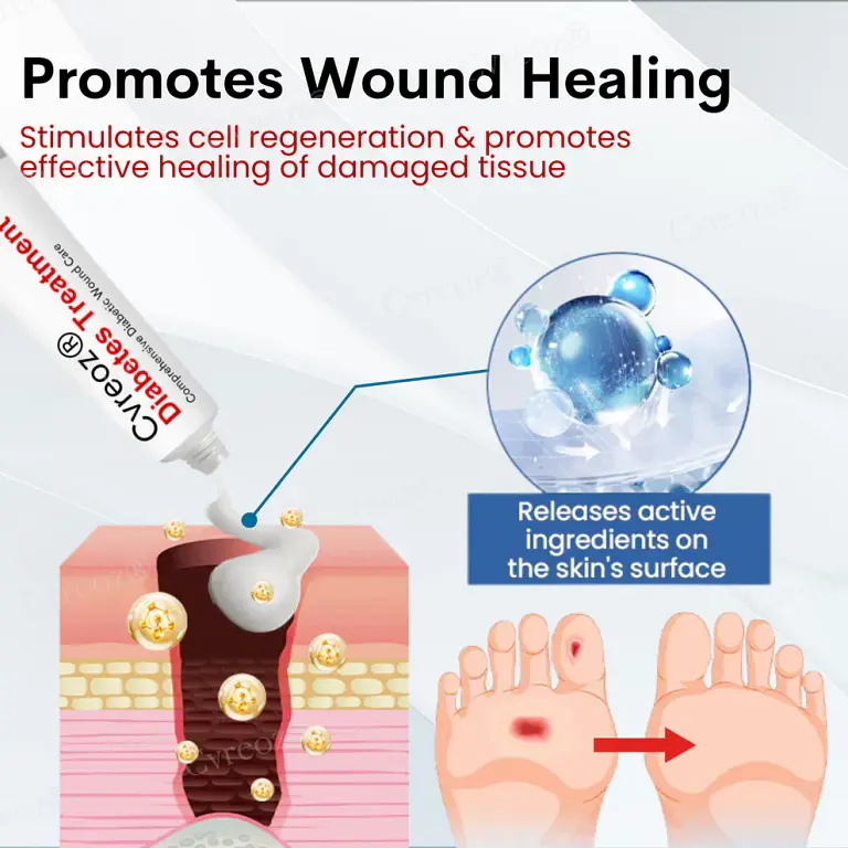 Cvreoz® Diabetes Treatment Cream 3 Cvreoz® Diabetes Treatment Cream