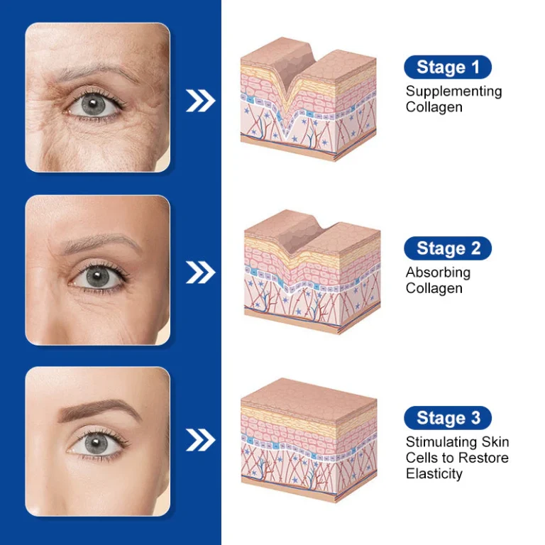 LOVILDS™ Bee Venom Skin Treatment Cream 2 LOVILDS™ Bee Venom Skin Treatment Cream