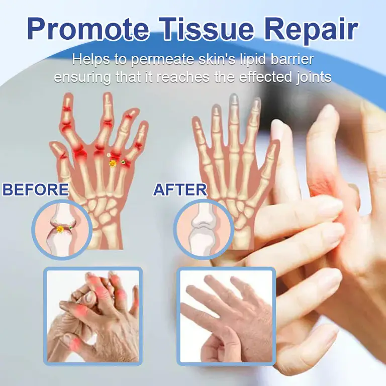 Ourlyard™ Magnesium Pain Healing Bone Cream 7 Ourlyard™ Magnesium Pain Healing Bone Cream