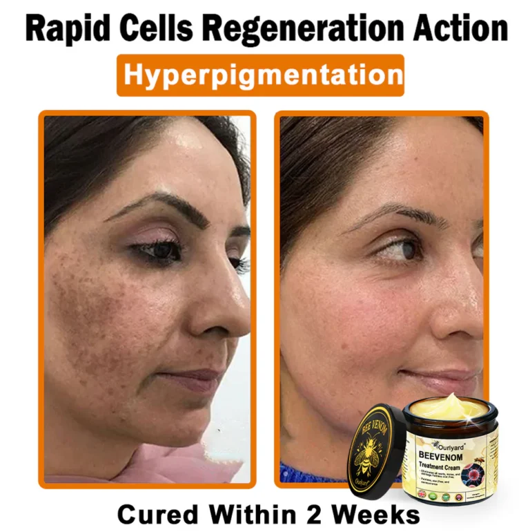 Ourlyard® Botulinum Toxin & Bee Venom Skin Treatment Cream 4 Ourlyard® Botulinum Toxin & Bee Venom Skin Treatment Cream