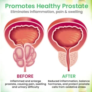 AEXZR™ Detox Prostate Care Patch 6 AEXZR™ Detox Prostate Care Patch