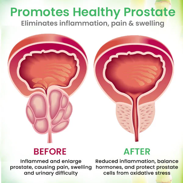 AEXZR™ Detox Prostate Care Patch 2 AEXZR™ Detox Prostate Care Patch