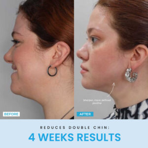 Liftlab Sculptor + Free Serum