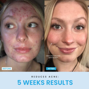 Liftlab Sculptor + Free Serum