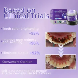 Oyikey™ TeethRestoration Mineral Powder 14 Oyikey™ TeethRestoration Mineral Powder