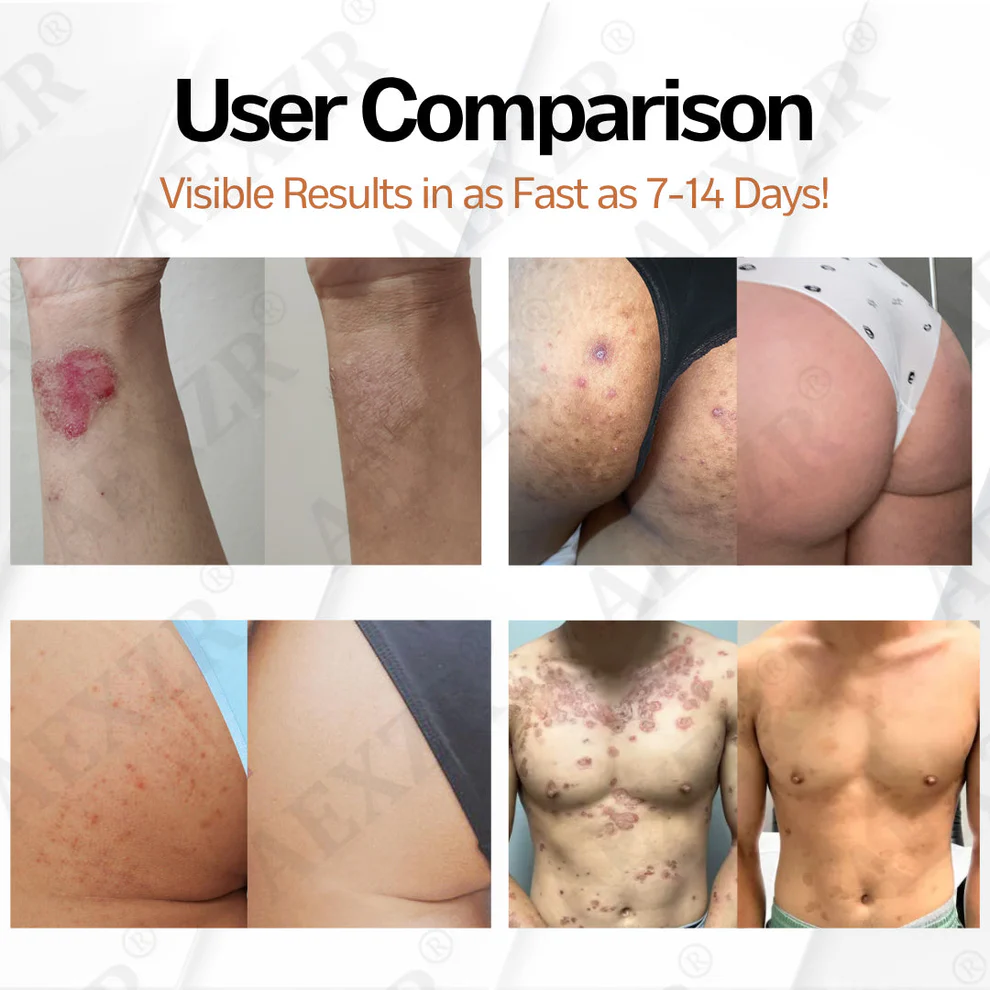 AEXZR® New Zealand Manuka Honey All-in-One Cream 3 AEXZR® New Zealand Manuka Honey All-in-One Cream