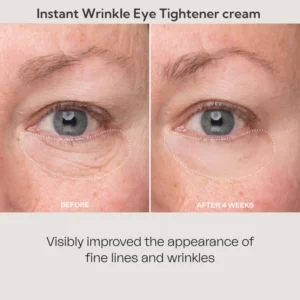 LOVILDS™Instant Wrinkle Eye Tightener cream 21 LOVILDS™Instant Wrinkle Eye Tightener cream