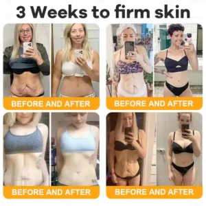 VLSVLS® Bee Venom Comprehensive Cream 21 VLSVLS® Bee Venom Comprehensive Cream