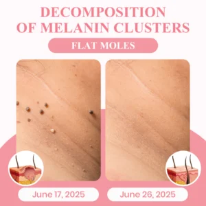 LUHAKA® Dual Acid Wart & Mole Removal Serum 19 LUHAKA® Dual Acid Wart & Mole Removal Serum