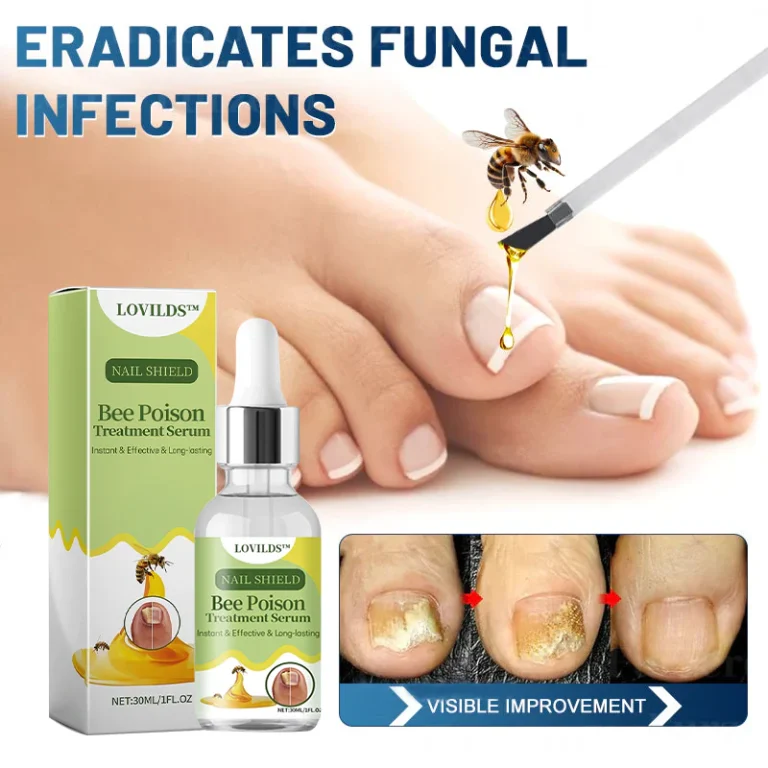 LOVILDS™ Nail Fungus Bee Poison Treatment Serum 10 LOVILDS™ Nail Fungus Bee Poison Treatment Serum