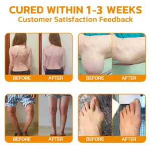 Dobshow™ Bee-Venom Pain-Relief Bone Healing Cream 24 Dobshow™ Bee-Venom Pain-Relief Bone Healing Cream