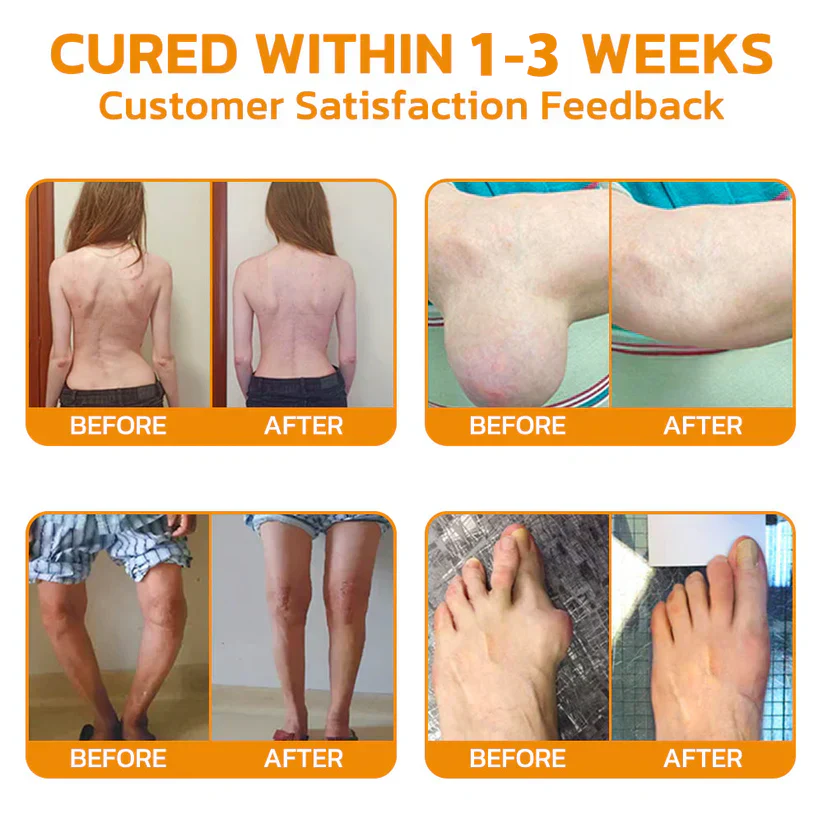 Dobshow™ Bee-Venom Pain-Relief Bone Healing Cream 11 Dobshow™ Bee-Venom Pain-Relief Bone Healing Cream