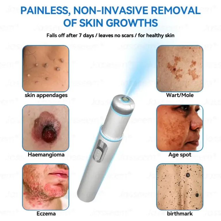 Jasseem® Non-Invasive Mole & Wart Laser Removal Pen 3 Jasseem® Non-Invasive Mole & Wart Laser Removal Pen