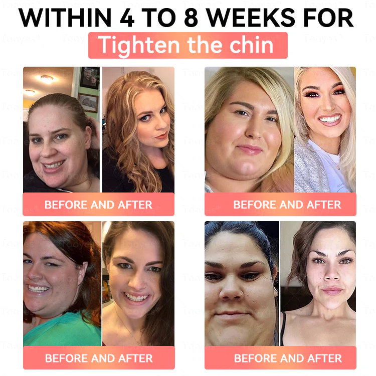 Tooyes® GLP-1 High-Concentration Liquid Pearls 7 Tooyes® GLP-1 High-Concentration Liquid Pearls