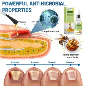 LOVILDS™ Nail Fungus Bee Poison Treatment Serum 19 LOVILDS™ Nail Fungus Bee Poison Treatment Serum