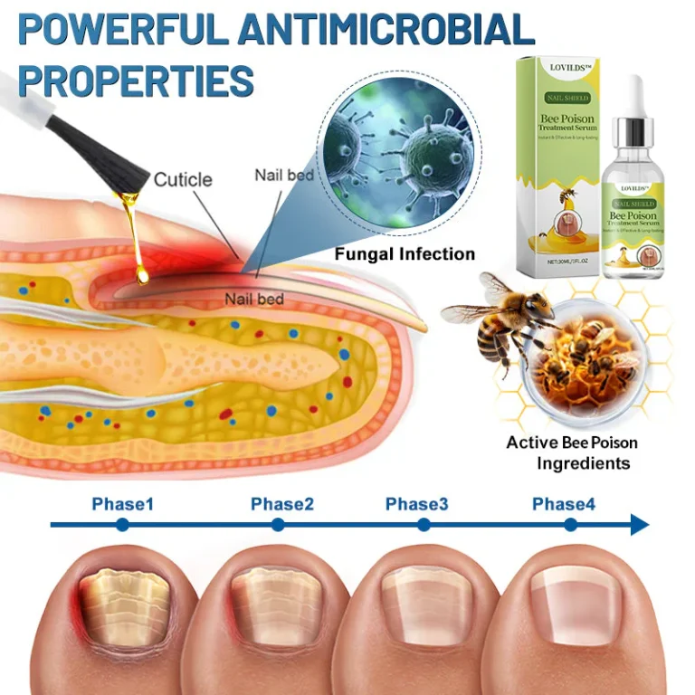 LOVILDS™ Nail Fungus Bee Poison Treatment Serum 9 LOVILDS™ Nail Fungus Bee Poison Treatment Serum